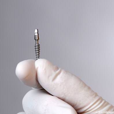 Mini-Implantat ohne Schneiden und Nähen